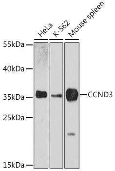 (KO Validated) CCND3 Polyclonal Antibody (E-AB-63262)