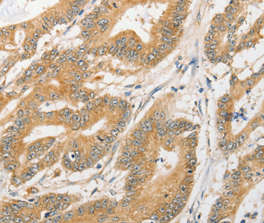 ATG5 Polyclonal Antibody (E-AB-14583)