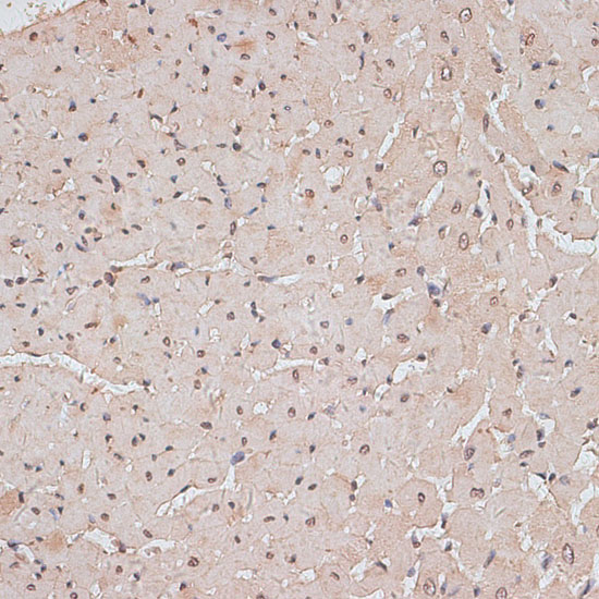 TLK1 Polyclonal Antibody (E-AB-65124)