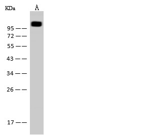 Recombinant CD146/MCAM Monoclonal Antibody (AN300561P)