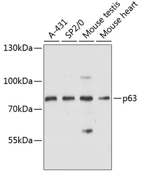 p63 Polyclonal Antibody (E-AB-64385)