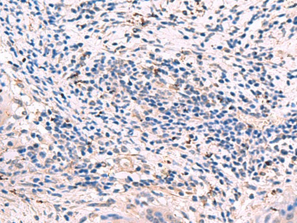 GKAP1 Polyclonal Antibody (E-AB-18819)