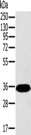 PPP2CA Polyclonal Antibody (E-AB-11494)