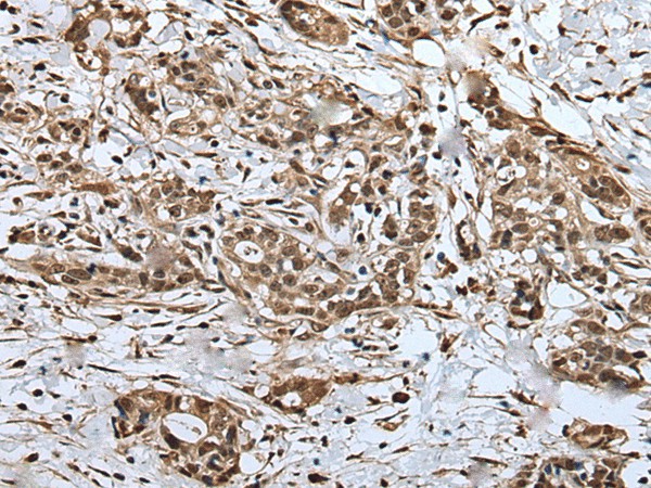 UPK3A Polyclonal Antibody (E-AB-18512)