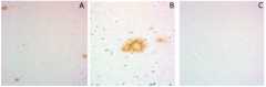 Purified anti-β-Amyloid, 1-38 Recombinant Antibody (943301)