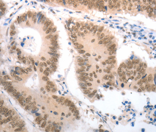 RAD52 Polyclonal Antibody (E-AB-15834)