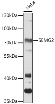 SEMG2 Polyclonal Antibody (E-AB-90500)
