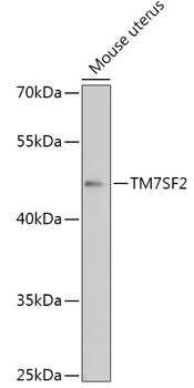 TM7SF2 Polyclonal Antibody (E-AB-91812)