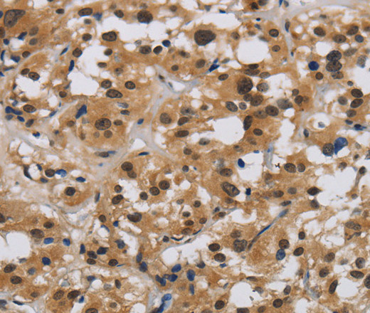 E2F4 Polyclonal Antibody (E-AB-12375)