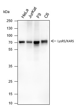 Recombinant LysRS Monoclonal Antibody (AN301592L)