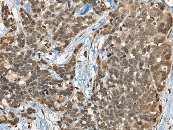 CBFA2T3 Polyclonal Antibody (E-AB-19667)