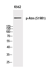 Phospho-ATM (Ser1981) Polyclonal Antibody (E-AB-21540)