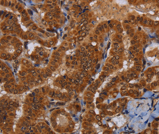 WDR83 Polyclonal Antibody (E-AB-15188)