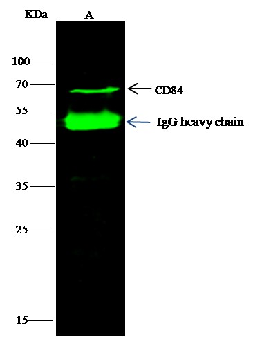 Recombinant CD84/SLAMF5 Monoclonal Antibody (AN300093P)
