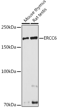 ERCC6 Polyclonal Antibody (E-AB-91996)