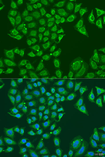 ALDH1B1 Polyclonal Antibody (E-AB-66392)