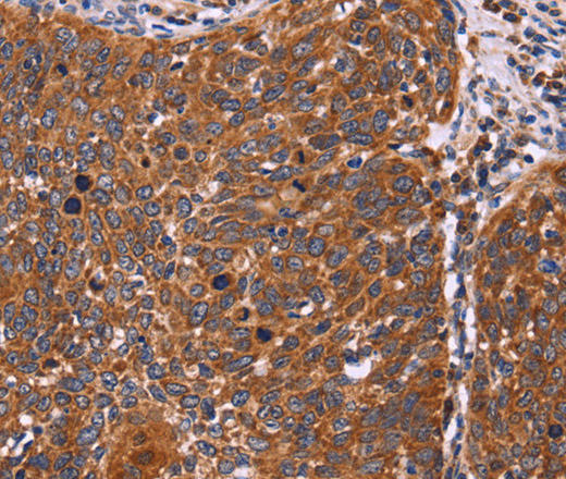 FBXW7 Polyclonal Antibody (E-AB-11064)