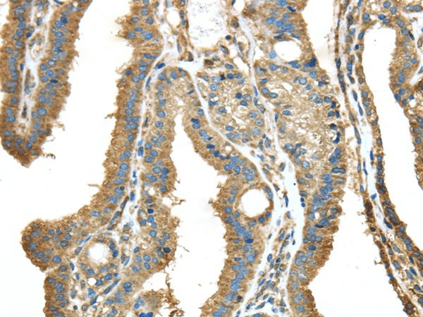 NME2 Polyclonal Antibody (E-AB-17456)