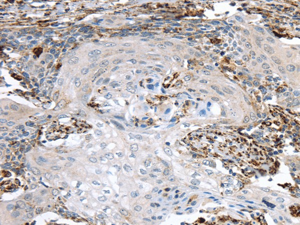 TBXA2R Polyclonal Antibody (E-AB-17492)