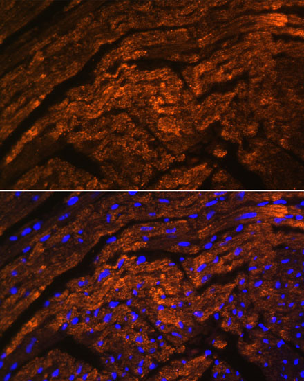 TTN Polyclonal Antibody (E-AB-66917)
