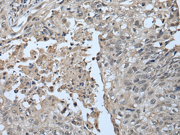UBR2 Polyclonal Antibody (E-AB-18505)