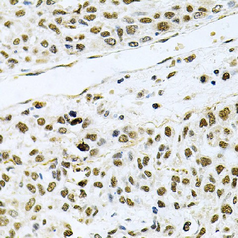 MCL1 Polyclonal Antibody (E-AB-60044)