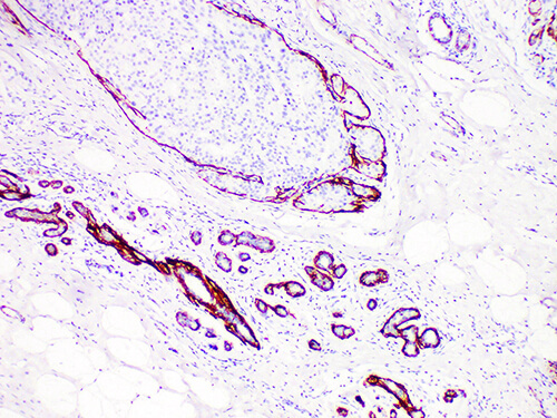 Calponin Monoclonal Antibody (ELAB6007-M)