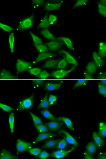 GAMT Polyclonal Antibody (E-AB-61237)