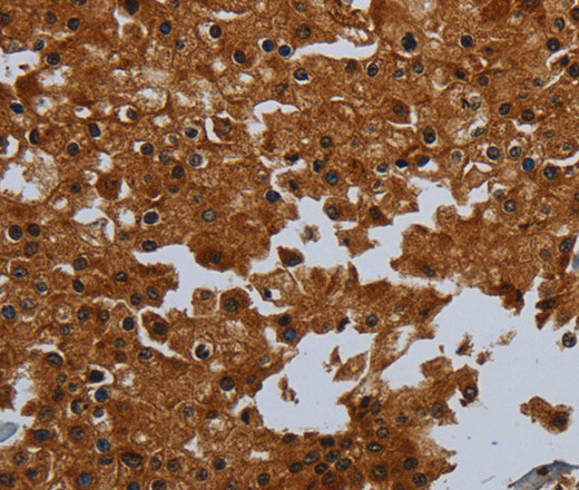 ENTPD7 Polyclonal Antibody (E-AB-11395)