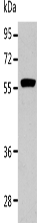 ALDH1A2 Polyclonal Antibody (E-AB-16146)