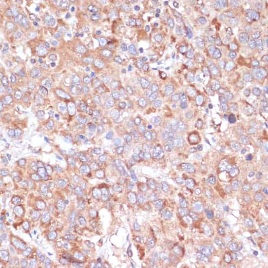 YAP1 Polyclonal Antibody (E-AB-62344)