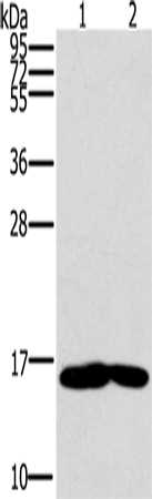 MB Polyclonal Antibody (E-AB-11417)