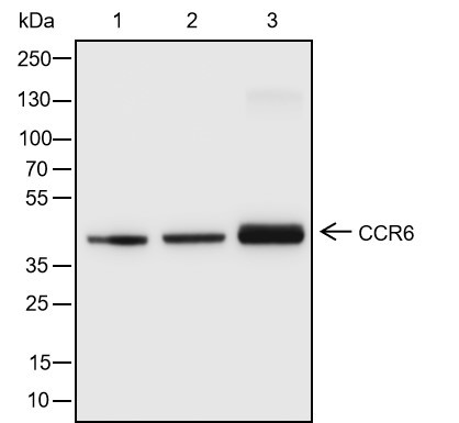 Recombinant CCR6 Monoclonal Antibody (AN301459L)