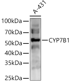 CYP7B1 Polyclonal Antibody (E-AB-91945)