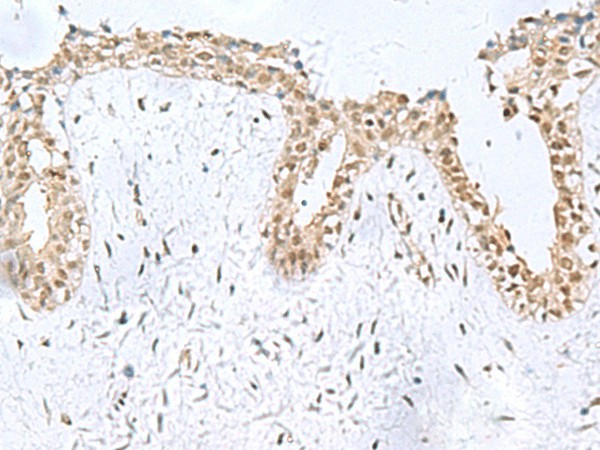 KDM2B Polyclonal Antibody (E-AB-18177)