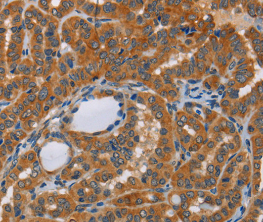 CK-13 Polyclonal Antibody (E-AB-10026)