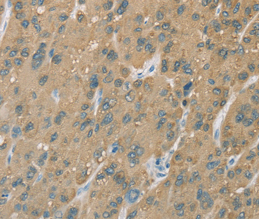CYP2C9 Polyclonal Antibody (E-AB-14908)