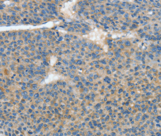 ATP4B Polyclonal Antibody (E-AB-13943)