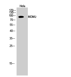 MDM2 Polyclonal Antibody (E-AB-31995)