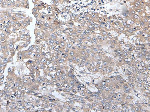 BRMS1L Polyclonal Antibody (E-AB-18331)