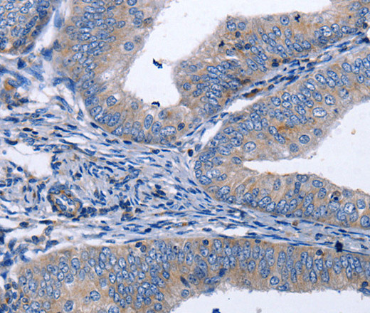 BDNF Polyclonal Antibody (E-AB-12290)