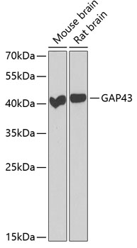 GAP43 Polyclonal Antibody (E-AB-61918)