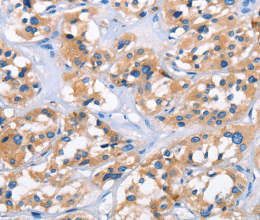 APOL6 Polyclonal Antibody (E-AB-13077)