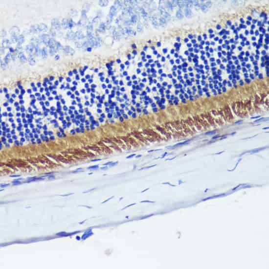 PDE6B Polyclonal Antibody (E-AB-61419)