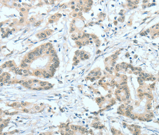 ASH2L Polyclonal Antibody (E-AB-10964)