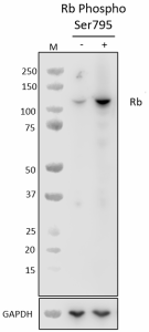 Purified anti-Rb Phospho (Ser795) Antibody (640451)
