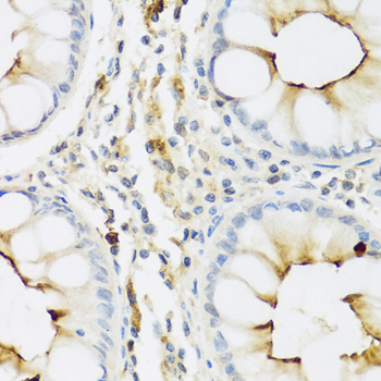 RNASE3 Polyclonal Antibody (E-AB-62895)