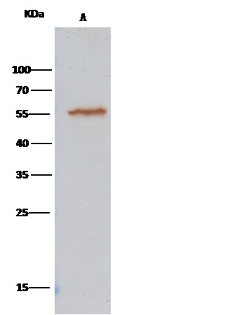 Recombinant ALDH7A1 Monoclonal Antibody (AN300070P)