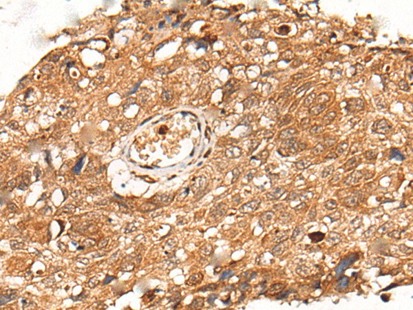 KLHL36 Polyclonal Antibody (E-AB-17745)