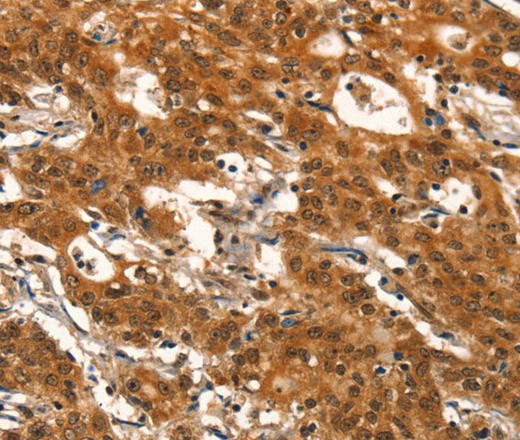 DEAF1 Polyclonal Antibody (E-AB-16381)